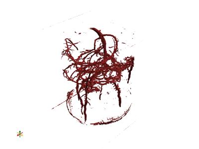 Baseline: pyvista-BinaryMarchingCubesReader-2187b1bbc4c45ed4_00_00_vtksz