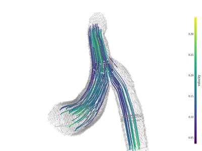 Baseline: sphx_glr_streamlines_002_vtksz